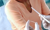 Những 'phiền toái' không thể ngờ vì cấy que tránh thai