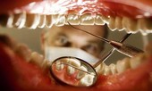 Đang lắp răng giả, cụ ông 'rơi' cả hàm vào phế quản suýt tắc thở