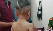 Bắt giam cha dượng hành hung dã man bé 3 tuổi