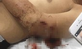 Người dân bị chém trọng thương khi xua đuổi 'cát tặc'