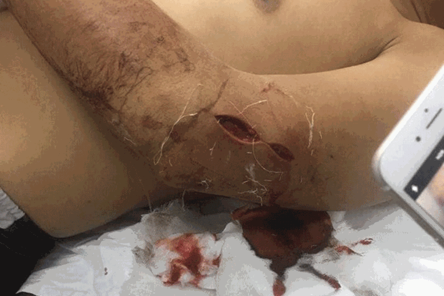 Người dân bị chém trọng thương khi xua đuổi 'cát tặc'