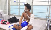 Vụ nổ tàu cá 14 người thương vong: Nhiều ngư dân bỏng trên 30%