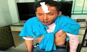Bé gái 12 tuổi tử vong sau khi bị người tình của mẹ thiêu sống