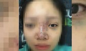 Bản tin 14H: Chủ spa tiêm filler cho sinh viên suýt mù mắt bỏ trốn