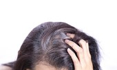 Vì sao nhiều người bị bạc tóc sớm?
