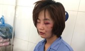 Khởi tố vụ nữ phụ xe buýt bị hành hung dã man ở Hà Nội