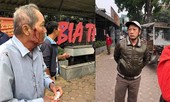 Công an điều tra vụ cụ ông 80 tuổi bị tài xế xe ôm đánh gãy xương sườn