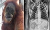 Đười ươi sống sót sau khi trúng 74 viên đạn ở Indonesia