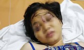 Bắt tạm giam một đối tượng đánh thai phụ đến sẩy thai