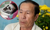 Vụ tạt axit, cắt gân chân Việt kiều: Bất ngờ lời kể của cha nạn nhân