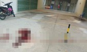 Bị chém gần đứt lìa tay khi đến nhà bạn chơi