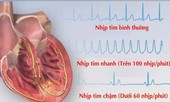 Bé gái mắc bệnh hiếm khiến tim đập nhanh 200 lần/ phút