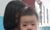 Tìm cách vá “lỗ hổng”
