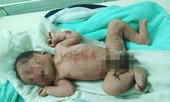 Bé trai sơ sinh bị bỏ rơi bên bờ suối
