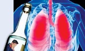 Mỗi cuộc nhậu không kiểm soát đều là ‘đường tắt’ đến ung thư gan
