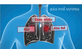 Ho, đờm kéo dài do viêm phế quản phải làm sao?