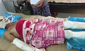 Phát nổ do rò rỉ khí ga trong đám tang, 5 người bỏng nặng