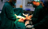 Nín thở xem bác sĩ mổ đẻ ngôi ngược