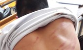 Tiếp thu bài chậm, bé trai 9 tuổi bị cha ruột đánh dã man