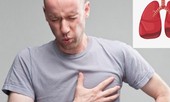 Cách đơn giản phòng căn bệnh 'sát thủ' khiến nhiều người Việt chết nhất
