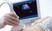 Dấu hiệu sớm căn bệnh ung thư 'sát thủ', người Việt mắc nhiều nhất