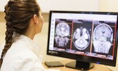 Đau đầu kiểu này, có thể mắc u não hoặc nhiều bệnh cực kỳ nguy hiểm