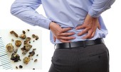 Hỏng cả đời vì coi thường 'mấy viên sỏi nhỏ' ở thận