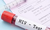 Xét nghiệm máu thông thường không thể phát hiện được HIV