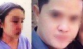 Vụ nữ nhân viên tố bị 'sếp' hành hung: Đình chỉ một bác sĩ để phục vụ điều tra