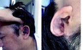 Tổng giám đốc 'vung tay', Chủ tịch HĐQT nhập viện
