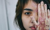 Thiếu úy công an mua 30 lít axit để tạt vợ sắp cưới: Hai lần ra tay tàn ác?