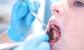Khoa học thường thức: Nghiêm túc một cách hài hước về sâu răng