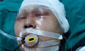 Gia đình nam sinh bị đánh đến mức phải mổ não cầu cứu