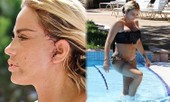 Katie Price mang mặt sẹo, bó căng ngực đi bơi hậu ‘đại tu’ ngoại hình