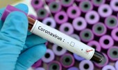 Giải mã cách virus corona xâm nhập và lây lan trong cơ thể
