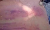 Dư luận bức xúc clip người đàn ông mù bị nhiều vết thương bầm tím