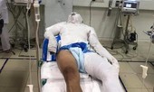 Lộ diện hung thủ tưới xăng đốt nam công nhân ở Vinh
