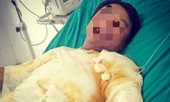 Đình chỉ 8 người liên quan vụ công nhân bị điện giật bỏng nặng