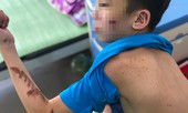 Gia cảnh thảm thương của cậu bé 14 tuổi bị chủ quán bánh xèo bạo hành dã man