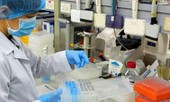 Mua sắm thiết bị, xét nghiệm COVID-19: Bộ Y tế phải công khai trúng thầu