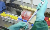 Vì sao bệnh nhân người Indonesia 'lúc âm lúc dương' với COVID-19?
