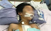 Nghi án bé trai thủng tim do bị đâm: Bệnh nhi đã tỉnh