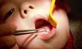 Cầm mặt dây chuyền chơi, bé gái nuốt luôn vào bụng