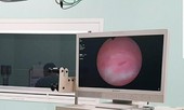 Kẹp tóc mắc kẹt trong cái âm đạo của bé gái suốt 3 tháng