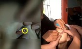 Trung Quốc: Bé gái suýt mù vì bị nhét giấy vào mắt