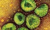 Hướng dẫn chẩn đoán, điều trị virus corona mới