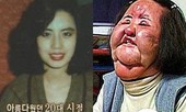 Bi kịch ‘thảm họa thẩm mỹ’ Hàn Quốc: Từ mỹ nhân hóa 'quái vật'