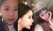 Sợ hãi với 'gương mặt rắn' của mẫu nữ 16 tuổi, đã phẫu thuật thẩm mĩ đến 70 lần