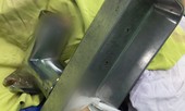 Rút nhầm phích cắm điện, người phụ nữ bị máy xay thịt cuốn nát bàn tay