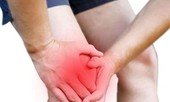 Proteoglycan- Giải pháp tối ưu từ Nhật Bản trong điều trị viêm khớp thoái hoá